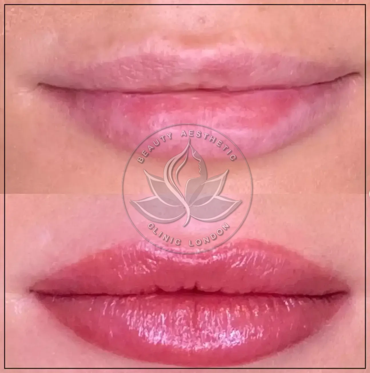 Lip Blushing London result